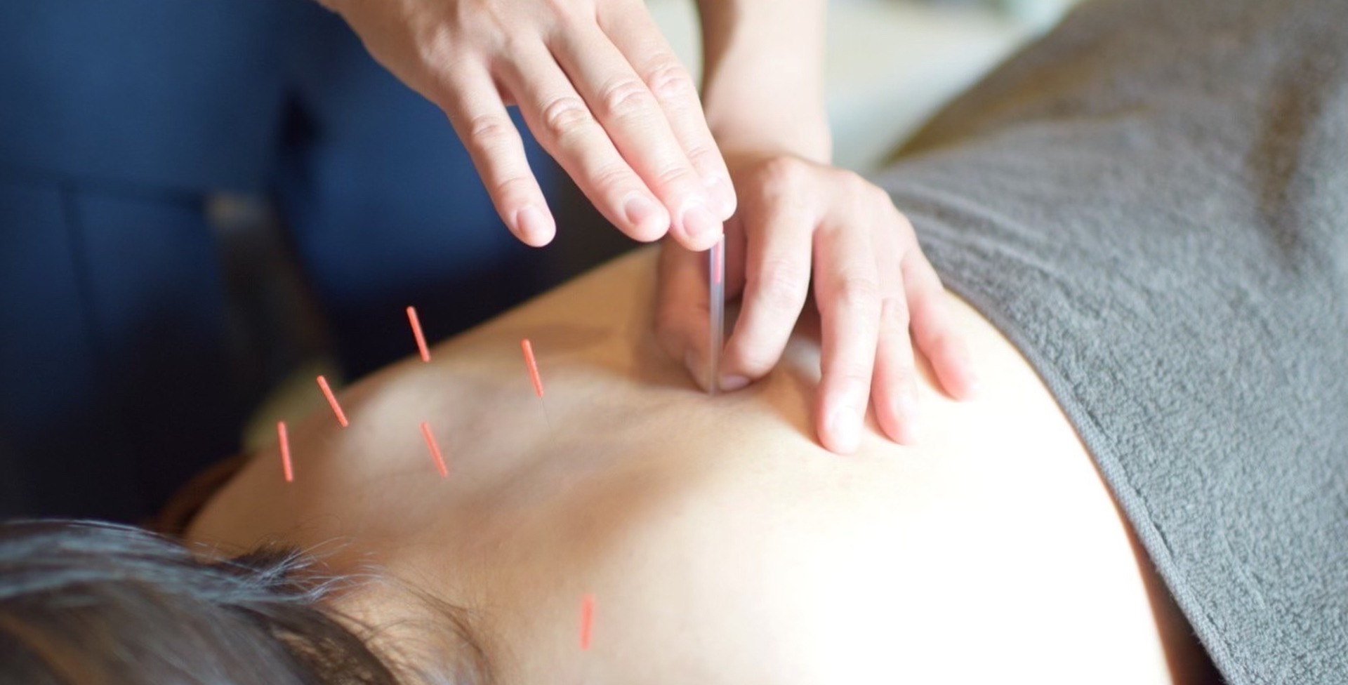 鍼灸